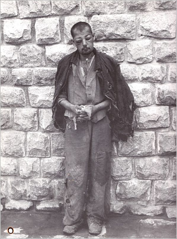 Battered inmate photographed by the SS during the operation of Mauthausen